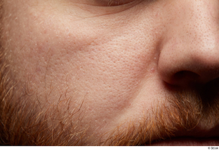 HD Face skin Michael Summers cheek face nose sin texture…
